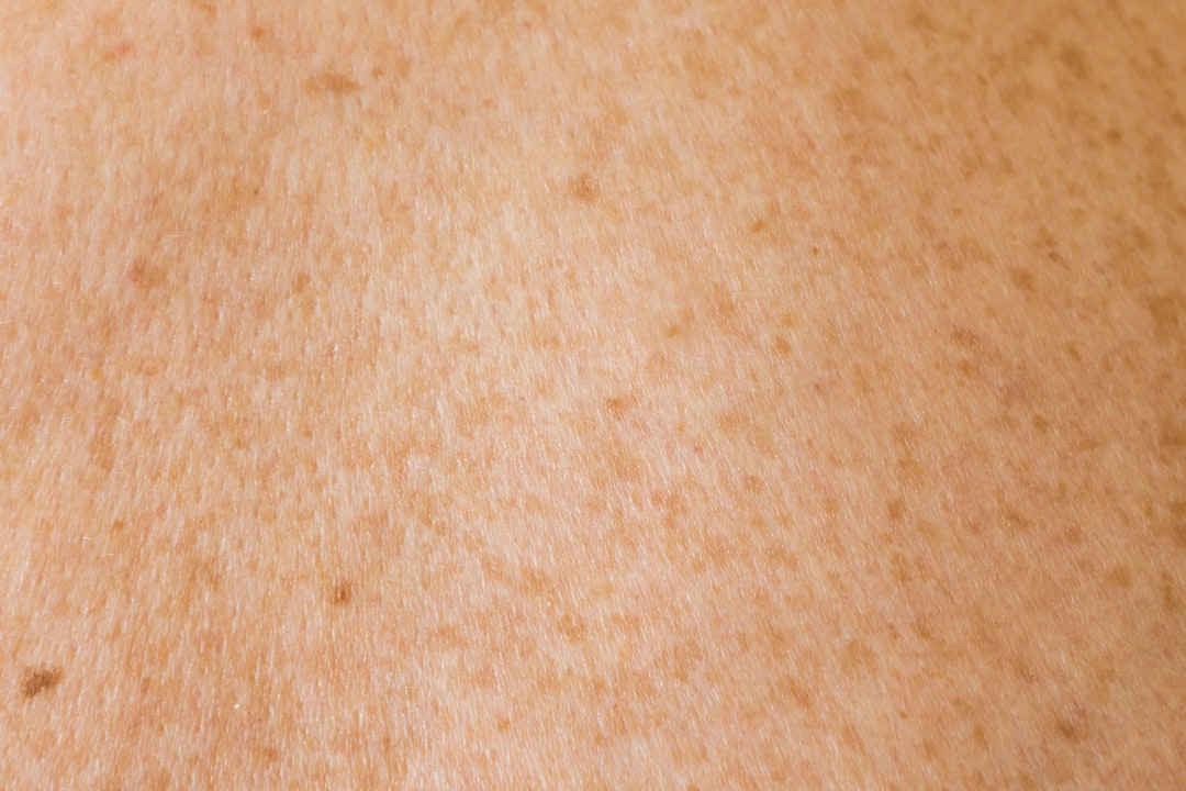 Melanina: O Que É (Glossário de Dermatologia)